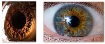iridiologie