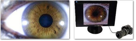 iridiologie