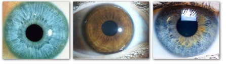 iridiologie